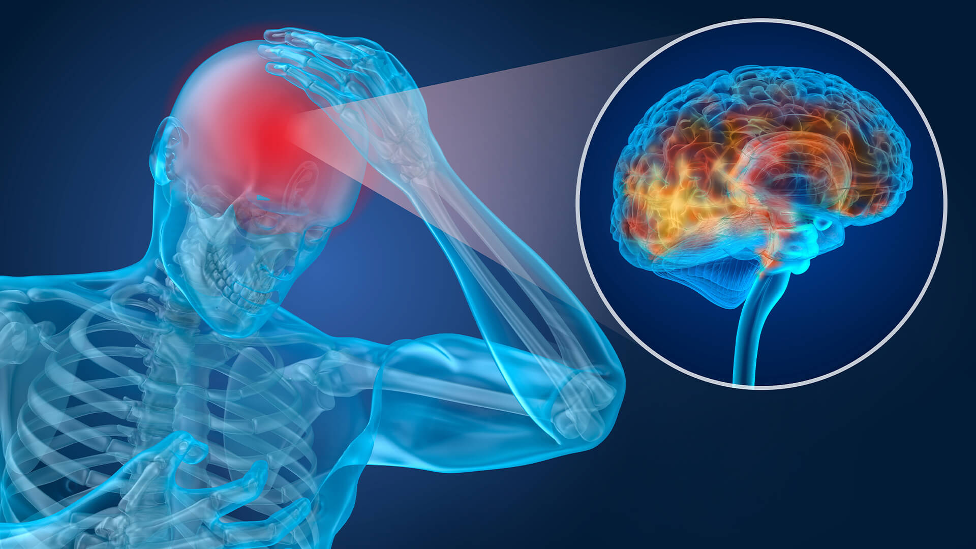 The Complete Guide to Concussions and How They Affect Your Life