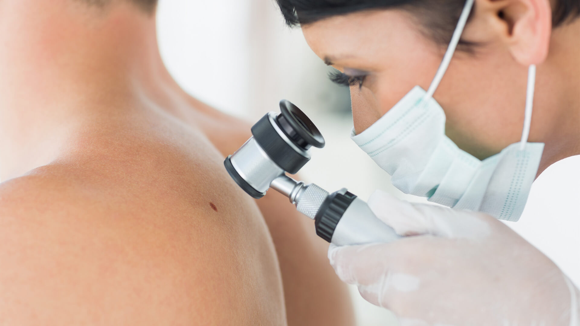 Abnormal Freckles And Moles: How to Check for Signs of Skin Cancer