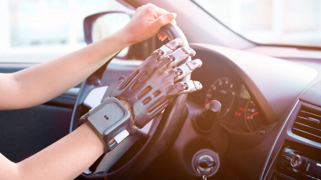 prosthetic hand driving car